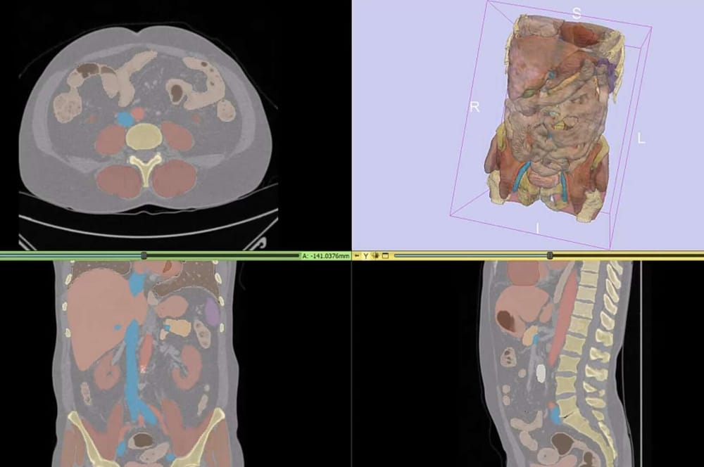 The Ultimate Guide to Medical Image Segmentation with Deep Learning (2D ...