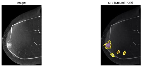 The Ultimate Guide to Medical Image Segmentation with Deep Learning (2D ...